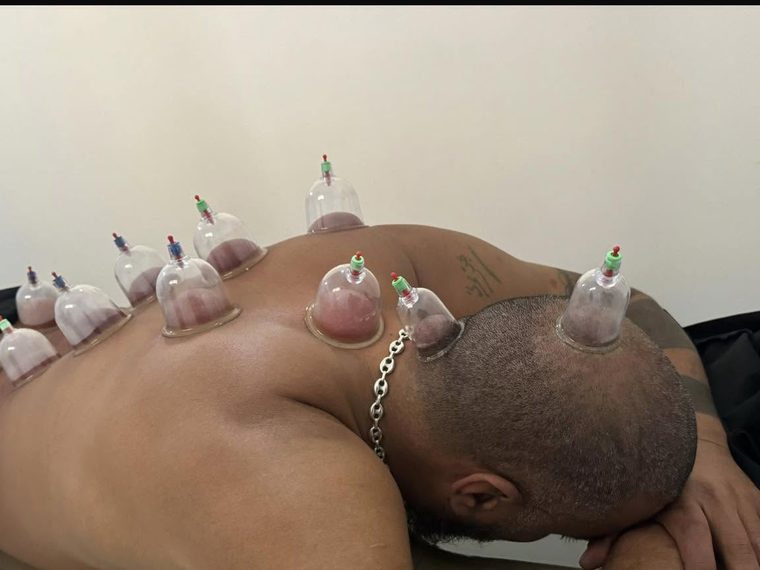 مريض أثناء جلسة حجامة بالعيادة